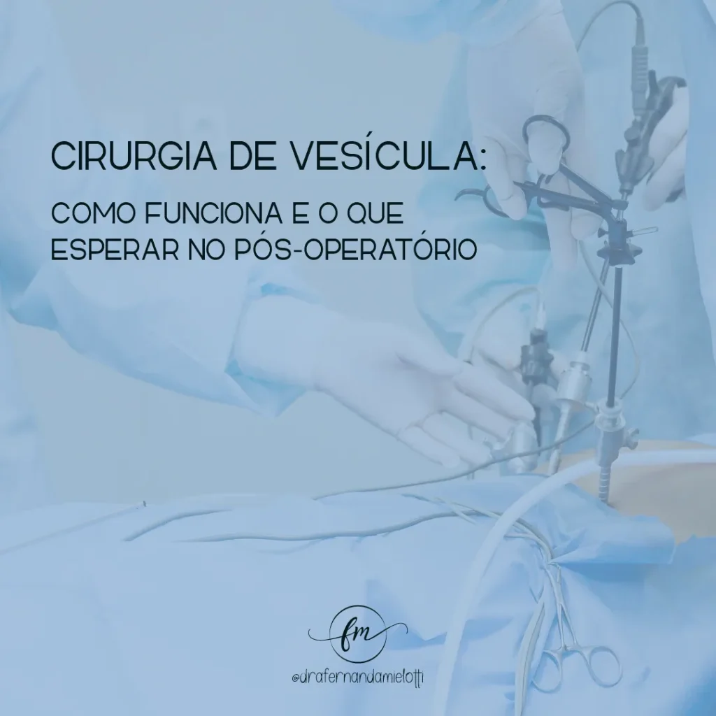 Cirurgia de Vesícula: Como Funciona e o Que Esperar no Pós-Operatório?