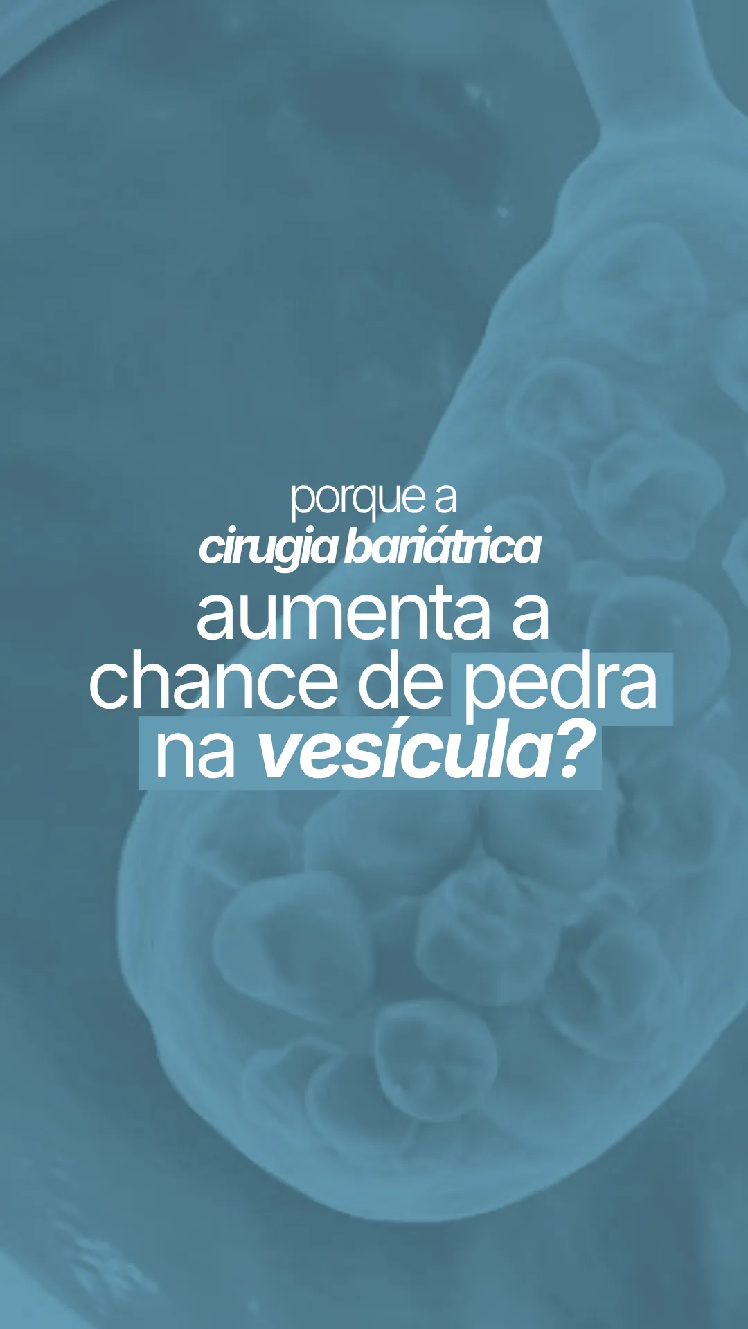 Cirurgia bariátrica e pedra na vesícula